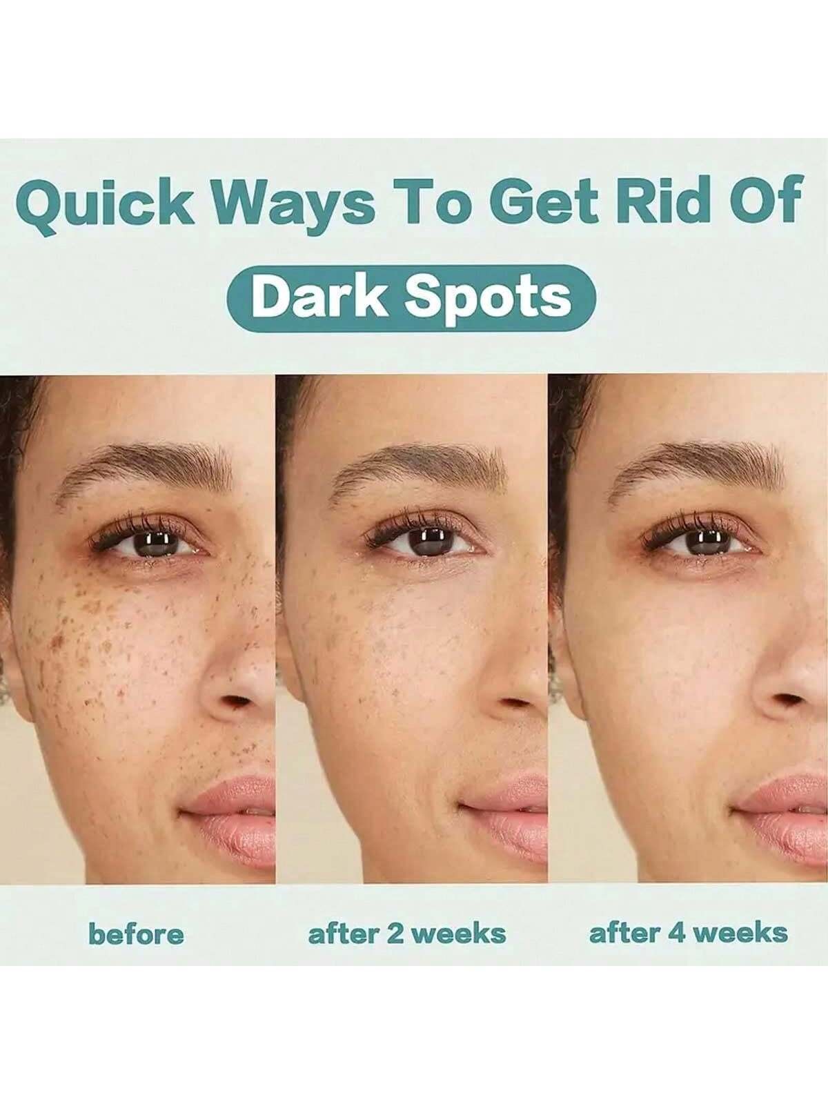 Effective Skin Lightening Cream 5ml/15ml/30ml/50ml/100ml Remove