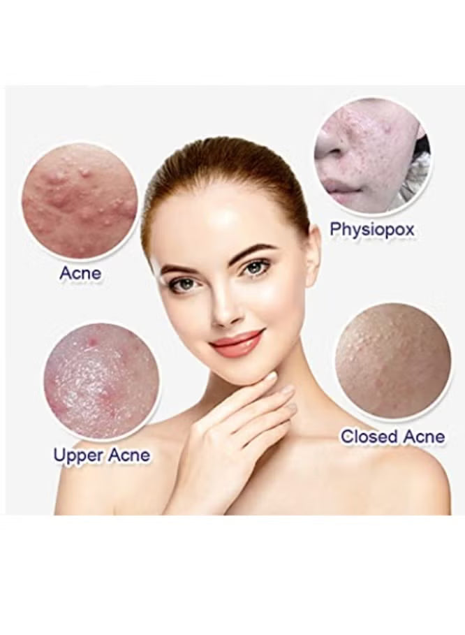 Anti-Acne Whitening Facial Serum