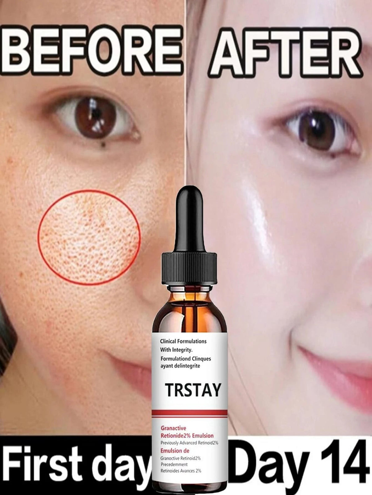 5ml/15ml/30ml/50ml/100ml Pore Minimizing Serum
