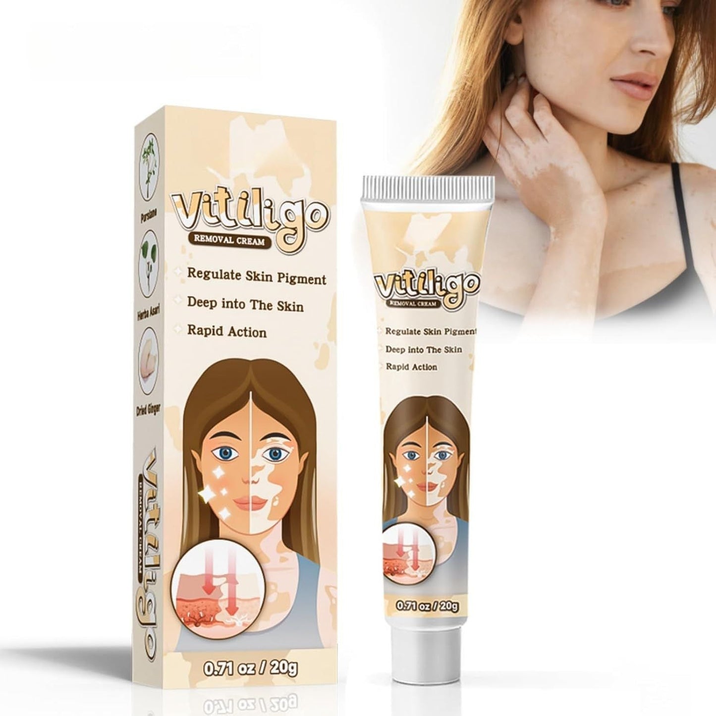 Vitiligo Removal Cream