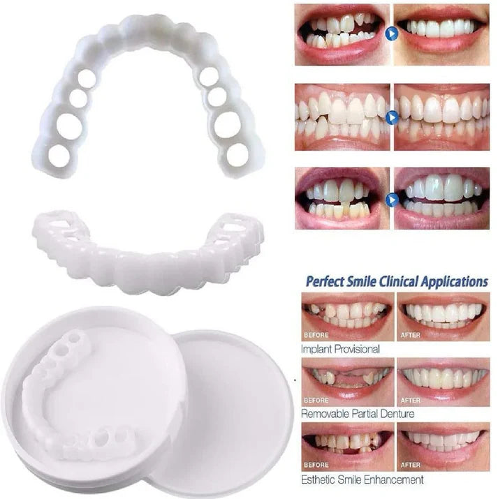 Snap-On Smile by DenMat