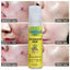 Temulawak - New Acne Removing Serum (Original)