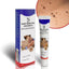 Warts Remover ointment