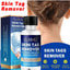 Skin Tag Remover