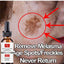 Effective Skin Lightening Cream 5ml/15ml/30ml/50ml/100ml Remove