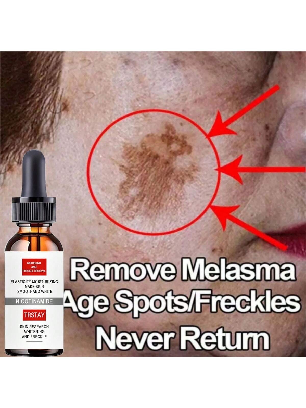 Effective Skin Lightening Cream 5ml/15ml/30ml/50ml/100ml Remove