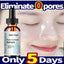5ml/15ml/30ml/50ml/100ml Pore Control & Skin Tightening Serum