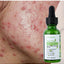 FATAZEN Organic Tea Tree Serum 30ml Natural Herbal Facial Care