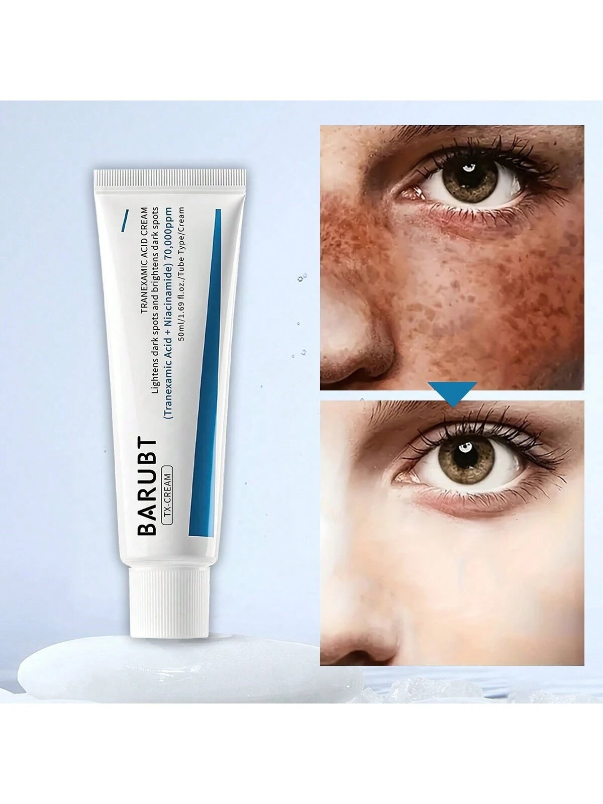 BARUBT Tranexamic Acid Cream 50ml, Removes Skin Spots