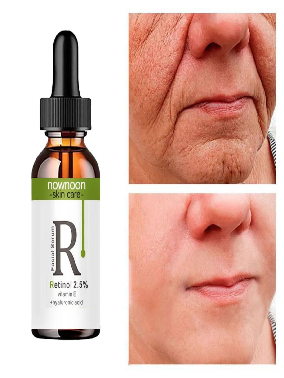5ml/15ml/30ml/50ml Retinol Anti Wrinkle Serum for Firming and Tightening