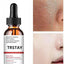 5ml/15ml/30ml/50ml/100ml Pore Minimizing Serum