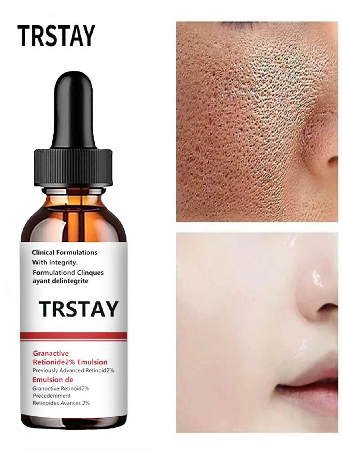 5ml/15ml/30ml/50ml/100ml Pore Minimizing Serum