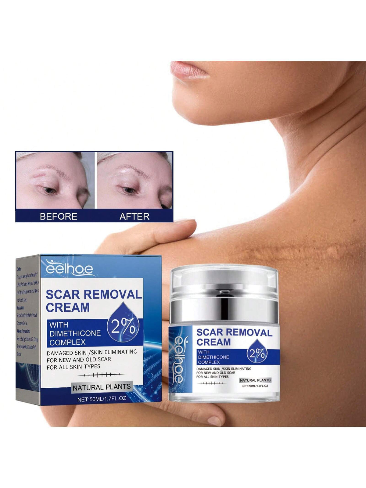 Scar Repair Cream 50ml Scar Lightening Skin Care Moisturizing Skin Care Cream