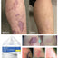 Skin Care Cream for Scars, Stretch Marks and Acne Skin, Scar Repair Cream for Scar Lightening and Skin Care