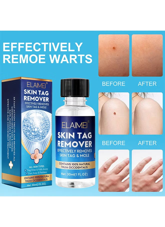 Skin Tag Remover