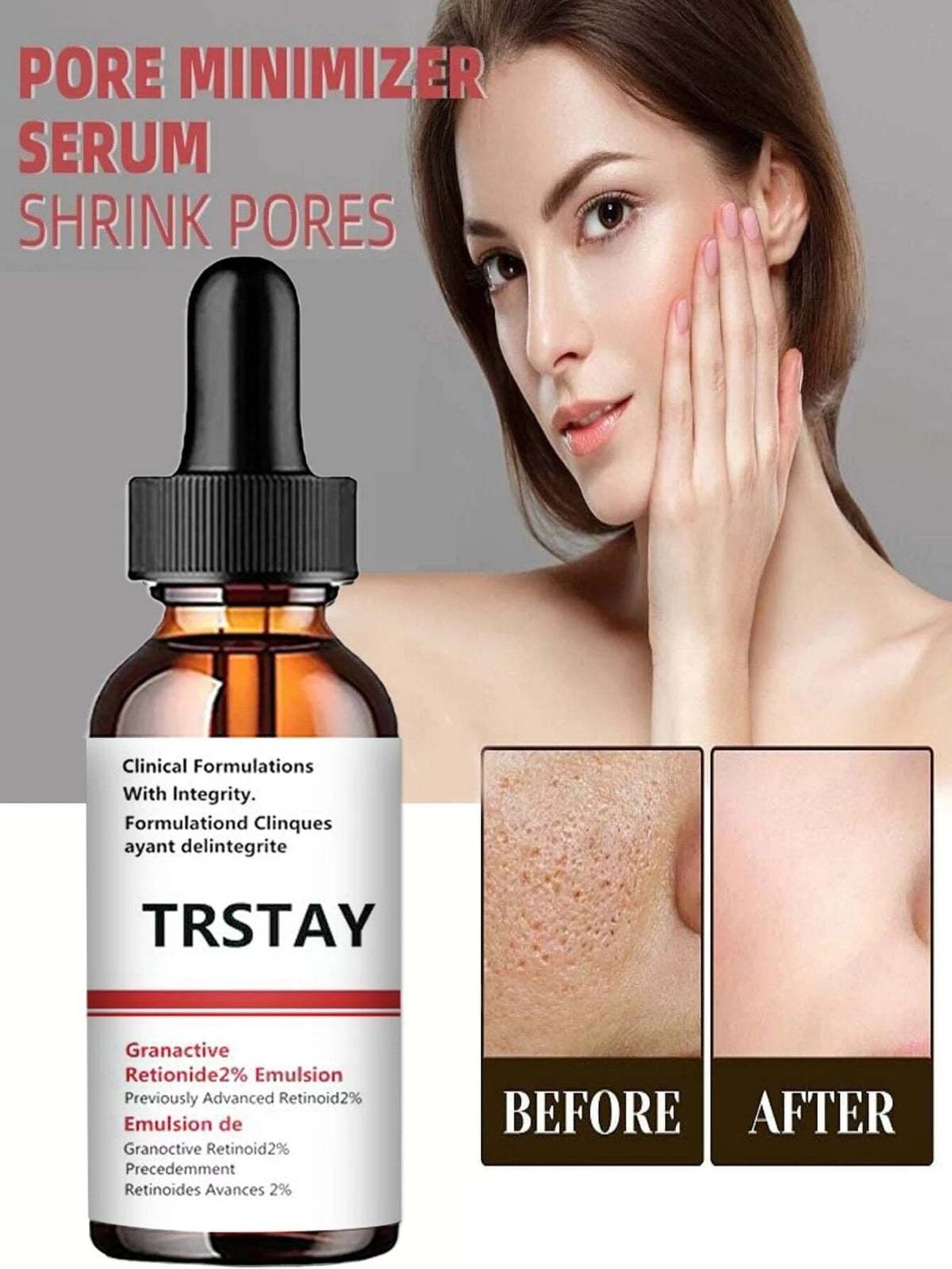 5ml/15ml/30ml/50ml/100ml Pore Minimizing Serum