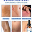 Scar Removal Moisturizer for Smooth Skin