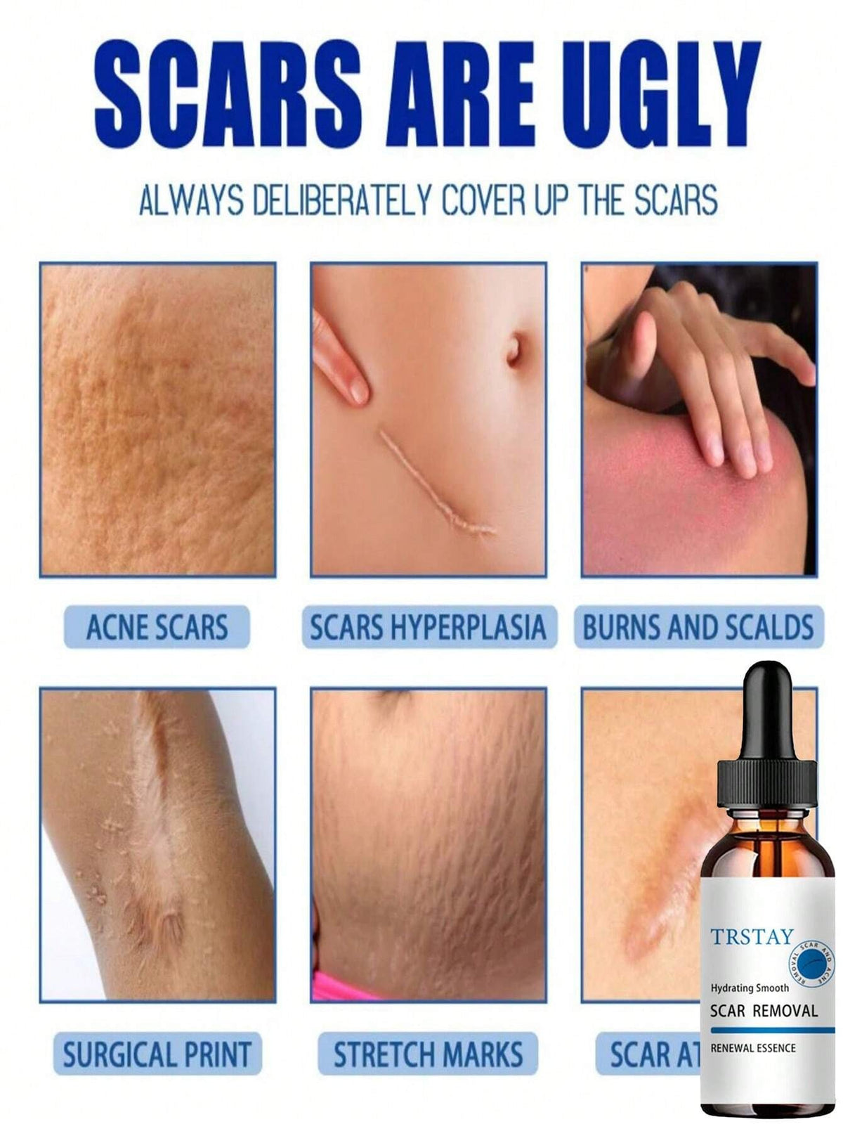 Scar Removal Moisturizer for Smooth Skin