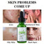 FATAZEN Organic Tea Tree Serum 30ml Natural Herbal Facial Care