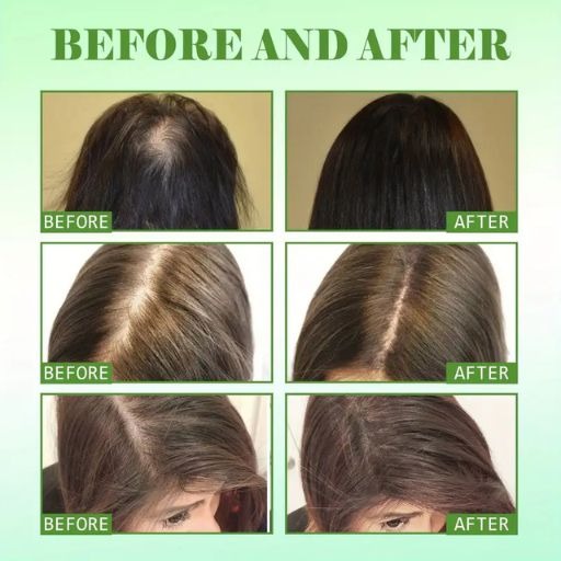60ml Rosemary Mint Scalp And Hair Strengthening Oil