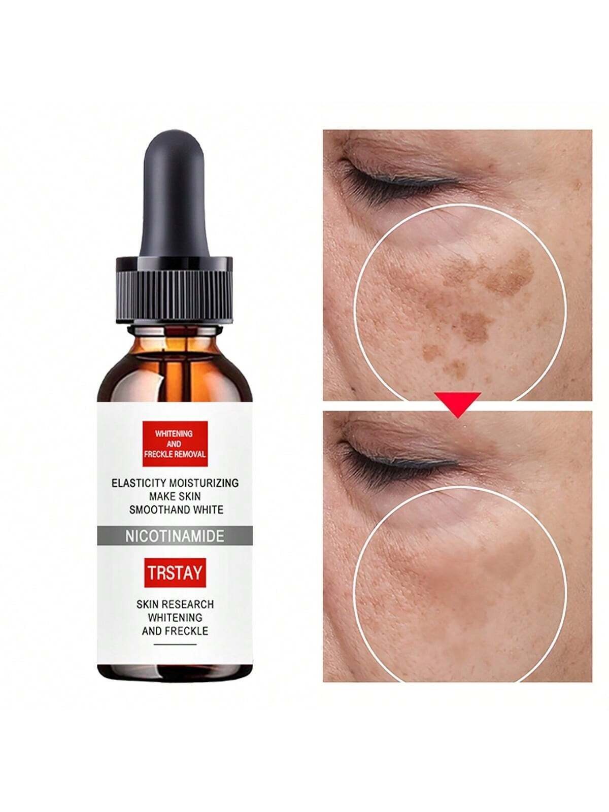Effective Skin Lightening Cream 5ml/15ml/30ml/50ml/100ml Remove