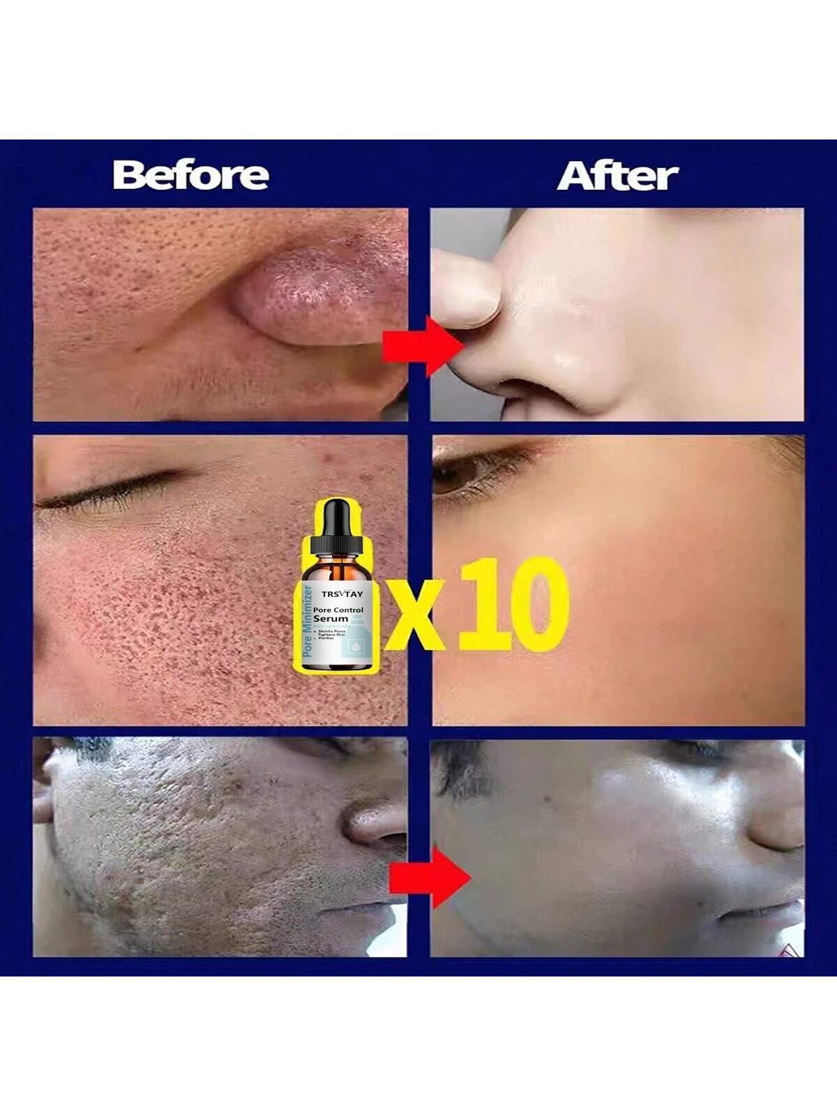 5ml/15ml/30ml/50ml/100ml Pore Control & Skin Tightening Serum