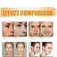 Kojic Acid Soap For Hyperpigmentation