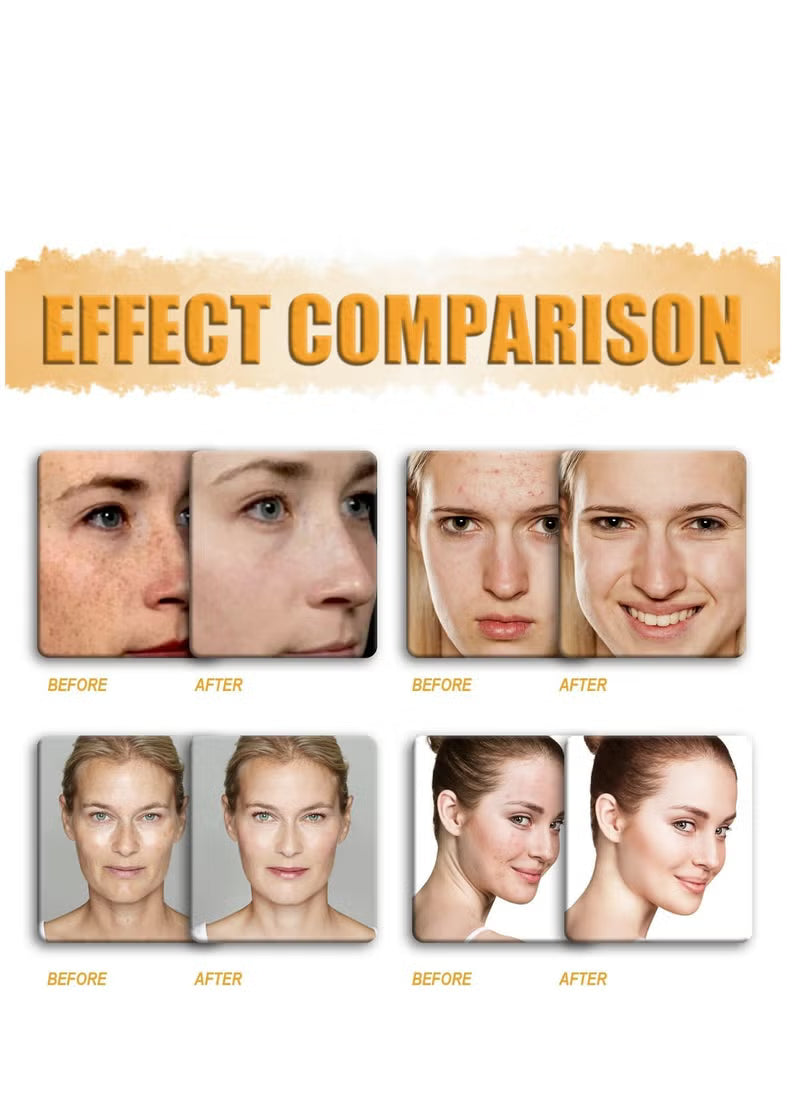 Kojic Acid Soap For Hyperpigmentation