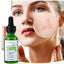 FATAZEN Organic Tea Tree Serum 30ml Natural Herbal Facial Care