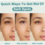 Effective Skin Lightening Cream 5ml/15ml/30ml/50ml/100ml Remove
