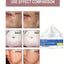 Skin Care Cream for Scars, Stretch Marks and Acne Skin, Scar Repair Cream for Scar Lightening and Skin Care