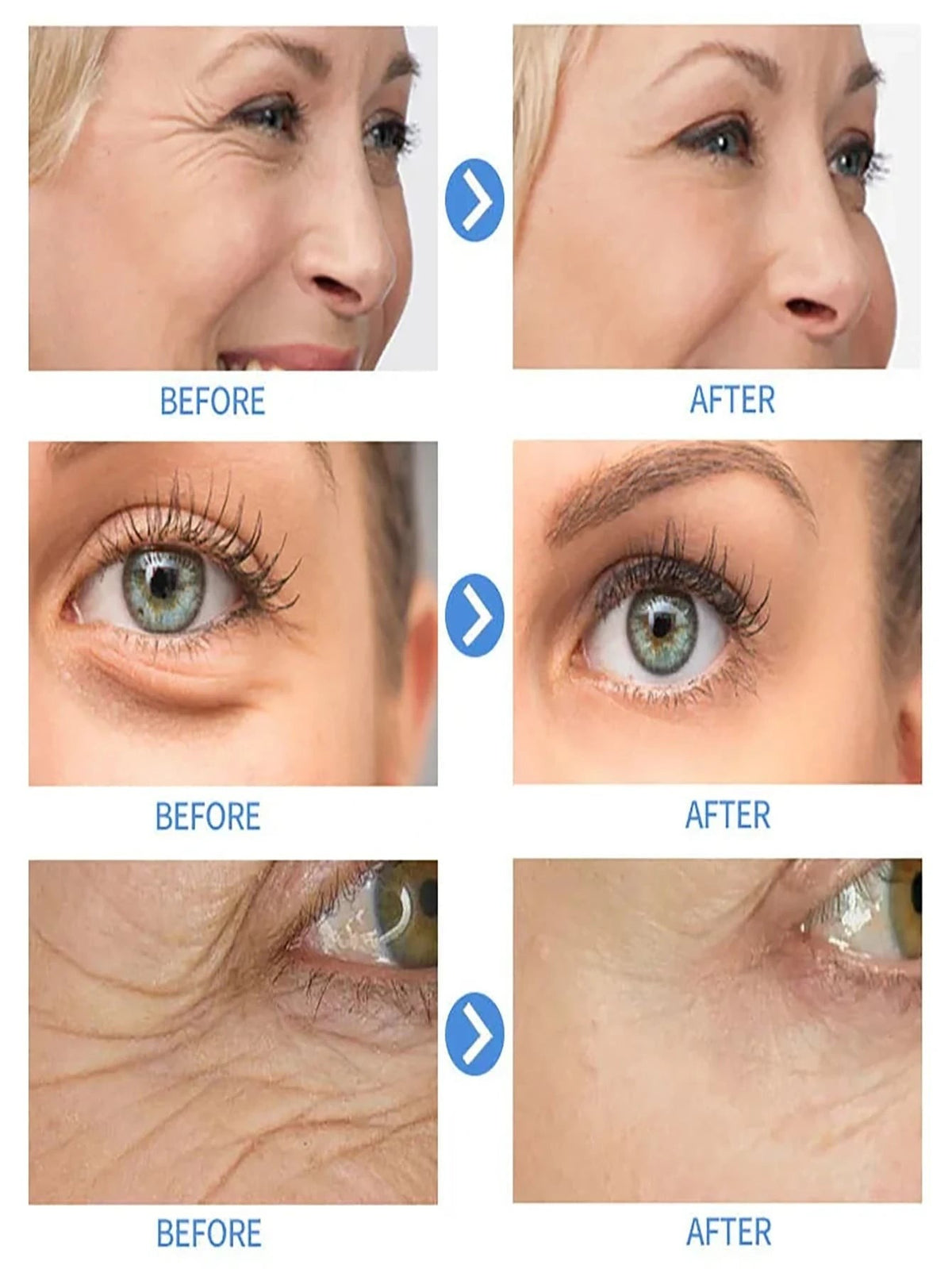 Anti Aging Retinol Serum, Firming and Lifting Face Serum