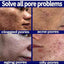 5ml/15ml/30ml/50ml/100ml Pore Control & Skin Tightening Serum