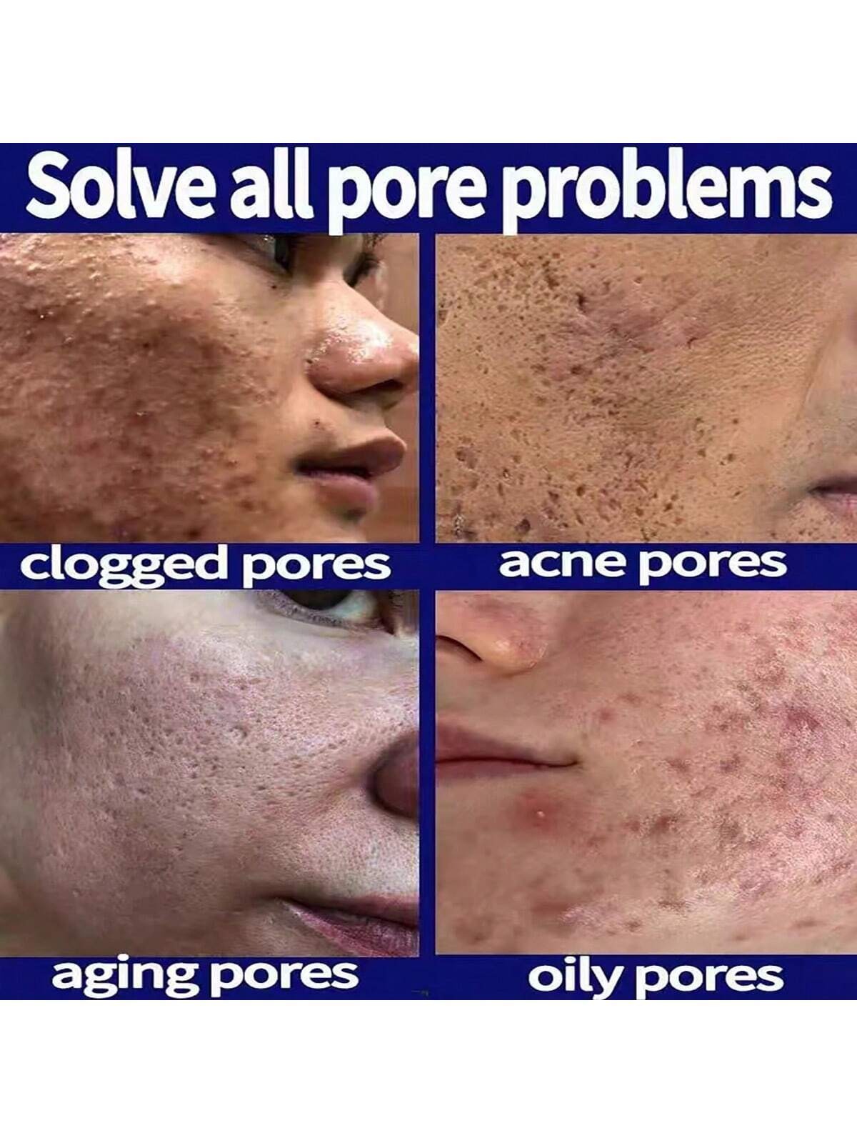 5ml/15ml/30ml/50ml/100ml Pore Control & Skin Tightening Serum