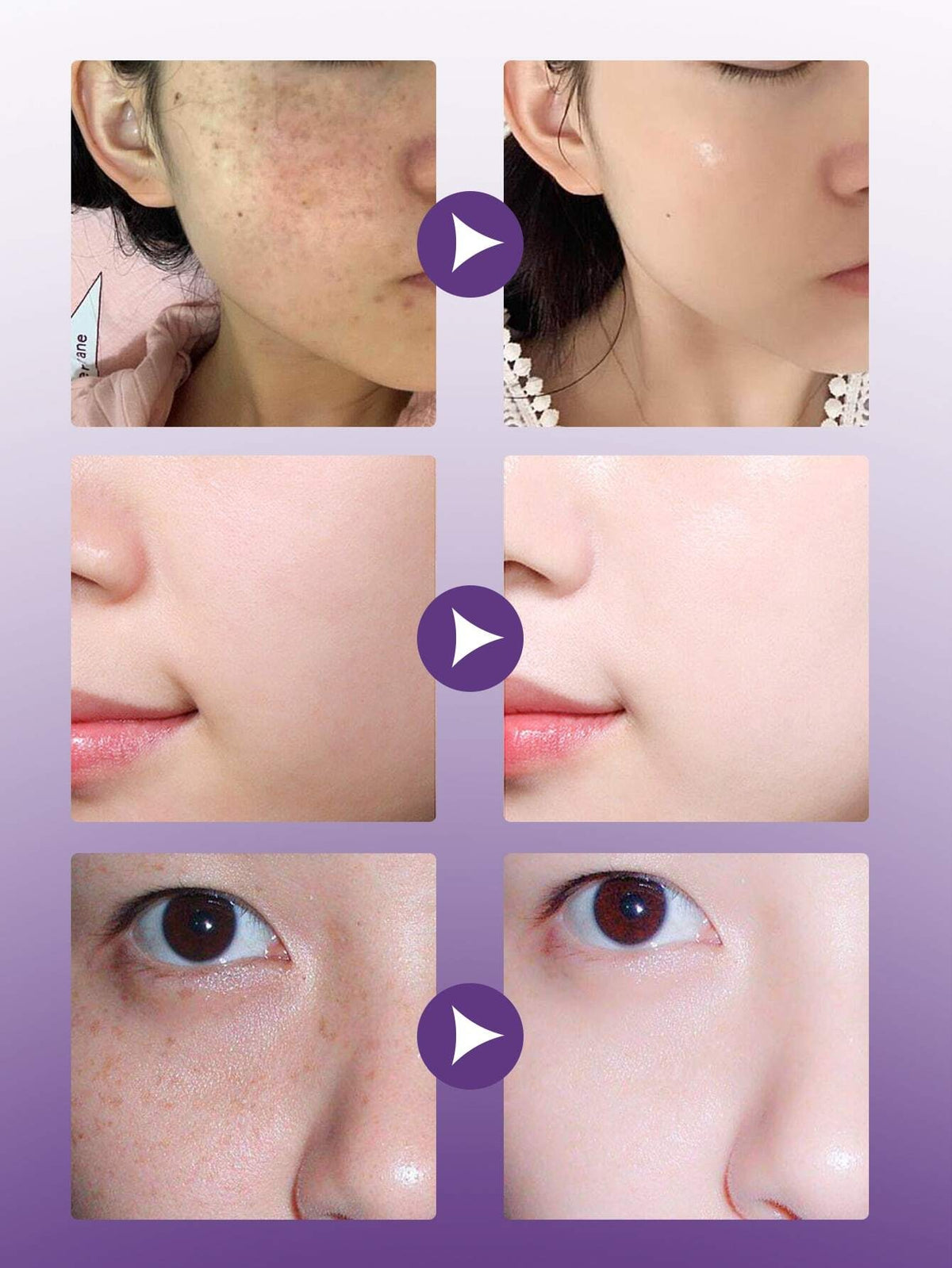 Facial Beauty Anti Aging Moisturizer Whitening Repair Facial Beauty Treats