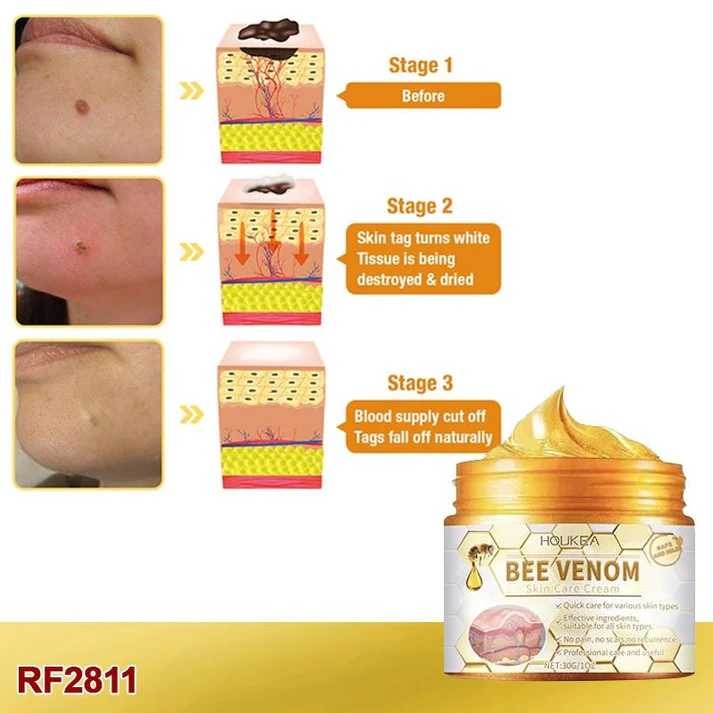 BEE VENOM