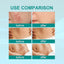 Medical Scar Removal Spray
